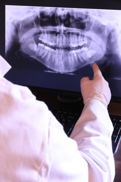 Best Emergency Dental Care for Abscessed Tooth in Mcdade, TX