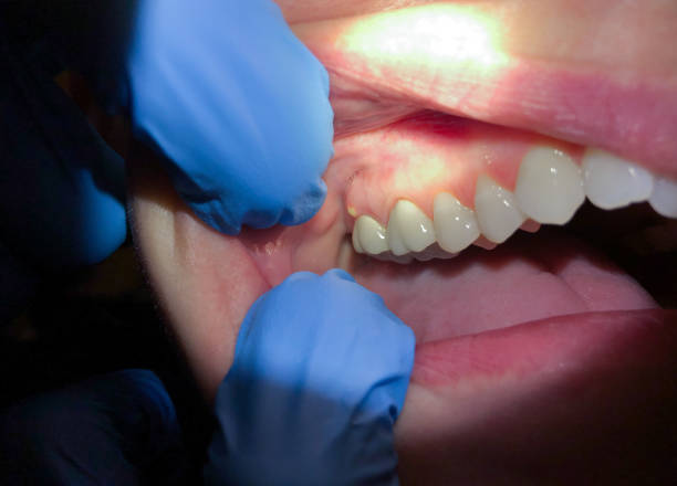 Best Pediatric Emergency Dentist in Mcdade, TX