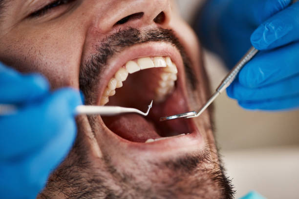 Best Broken or Cracked Tooth Emergency Dentist in Mcdade, TX