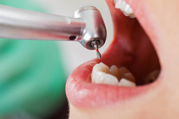 Best Mobile Emergency Dentist in Mcdade, TX